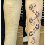 Tatouage sur cicatrices