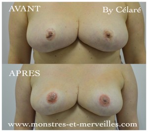 seins vue de face